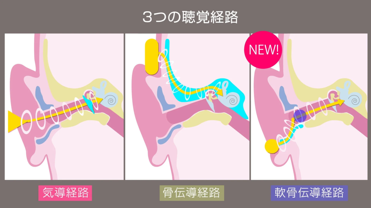 Diagram of three auditory pathways