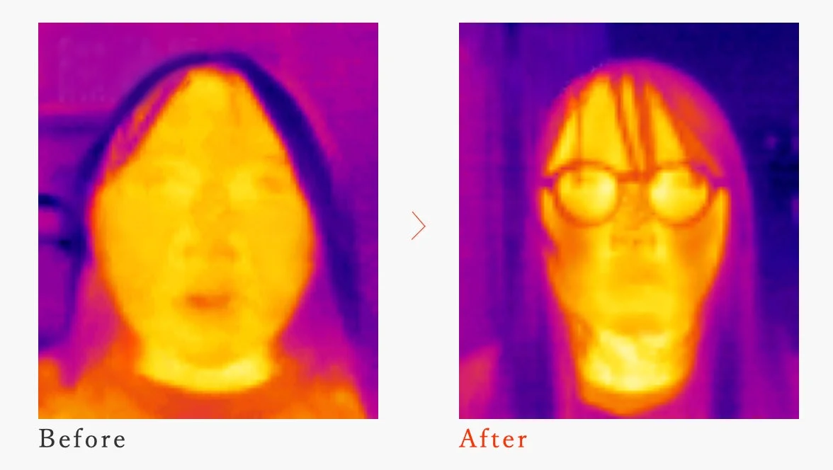 Thermography Before After