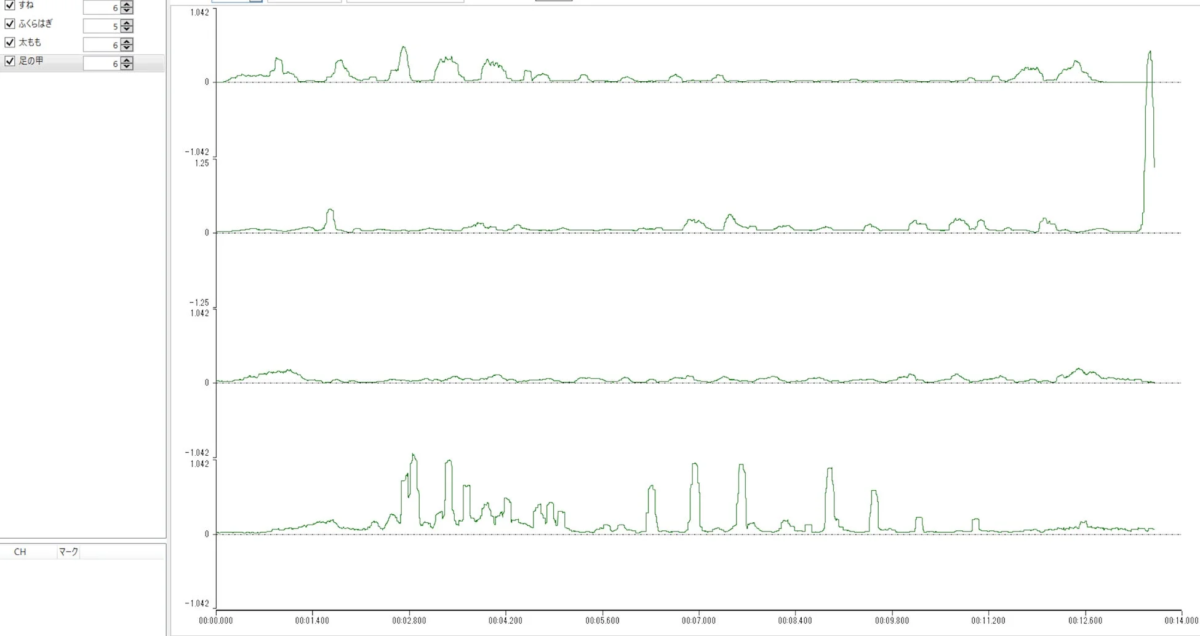 Electromyogram graph showing muscle activity