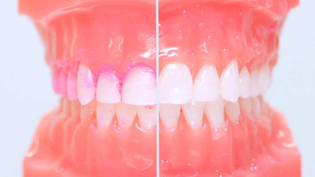 Toothbrush comparison before after