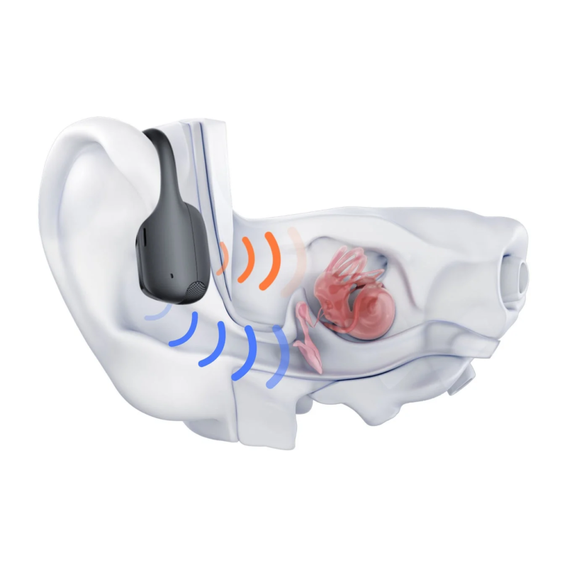 Ear anatomy with audio device